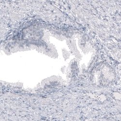 Astrin Antibody (CL10078), Novus Biologicals 100 &mu;L | Buy Online | Novus Biologicals | Fisher Scientific