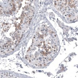 Astrin Antibody (CL10078), Novus Biologicals 100 &mu;L | Buy Online | Novus Biologicals | Fisher Scientific