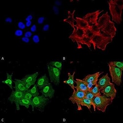 Ataxin 1 Antibody (S76-8), Novus Biologicals 0.1 mg; Unconjugated:Antibodies,