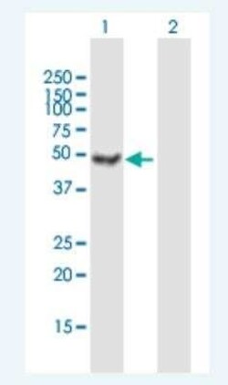 Ataxin-10 Antibody, Novus Biologicals 50 &mu;g | Buy Online | Novus Biologicals | Fisher Scientific