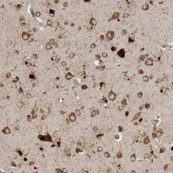 Ataxin-2 Antibody, Novus Biologicals 0.1 mL | Buy Online | Novus Biologicals | Fisher Scientific