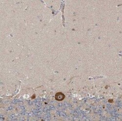 Ataxin-2 Antibody, Novus Biologicals 0.1 mL | Buy Online | Novus Biologicals | Fisher Scientific