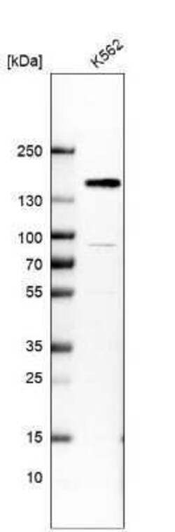 Ataxin-2 Antibody, Novus Biologicals 0.1 mL | Buy Online | Novus Biologicals | Fisher Scientific