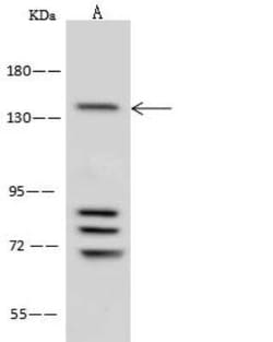Ataxin-2 Antibody, Novus Biologicals 100 &mu;g | Buy Online | Novus Biologicals | Fisher Scientific