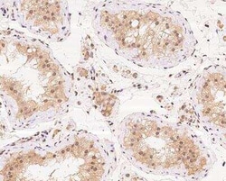 Ataxin-3 Antibody, Novus Biologicals 100 &mu;g | Buy Online | Novus Biologicals | Fisher Scientific