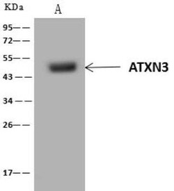 Ataxin-3 Antibody, Novus Biologicals 100 &mu;g | Buy Online | Novus Biologicals | Fisher Scientific