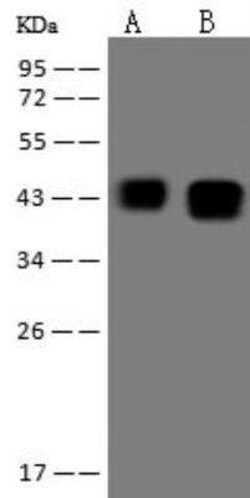Ataxin-3 Antibody, Novus Biologicals 100 &mu;g | Buy Online | Novus Biologicals | Fisher Scientific