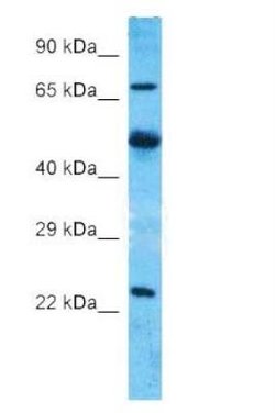Axotrophin Antibody, Novus Biologicals 100 &mu;L | Buy Online | Novus Biologicals | Fisher Scientific