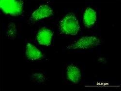 Azurocidin/CAP37/HBP Antibody, Novus Biologicals 0.05 mg | Buy Online | Novus Biologicals | Fisher Scientific