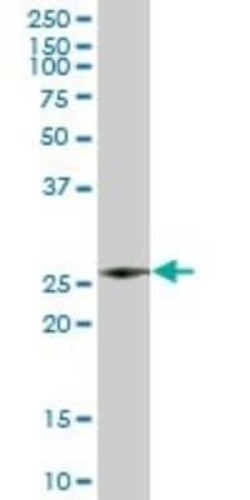 Azurocidin/CAP37/HBP Antibody, Novus Biologicals 0.05 mg | Buy Online | Novus Biologicals | Fisher Scientific