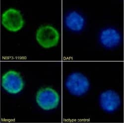 B220/CD45R Rabbit anti-Mouse, Clone: RA3-6B2, Novus Biologicals 0.2 mg;