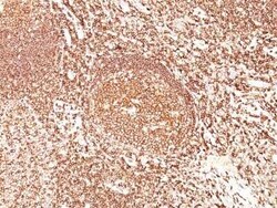 B220/CD45R Antibody (F10-89-4), Novus Biologicals:Antibodies:Primary Antibodies