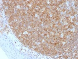 B220/CD45R Antibody (F10-89-4), Novus Biologicals:Antibodies:Primary Antibodies