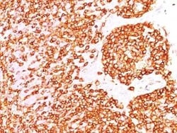 B220/CD45R Antibody (PTPRC/1460), Novus Biologicals:Antibodies:Primary