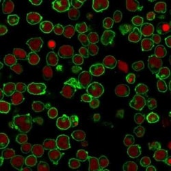 B220/CD45R Antibody (PTPRC/1461), Novus Biologicals 100&mu;g; Unlabeled:Antibodies,
