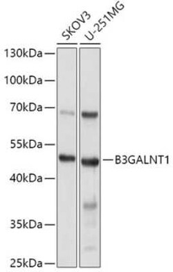 B3GALNT1 Antibody - BSA Free, Novus Biologicals:Antibodies:Primary Antibodies