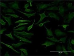 B3GALT2 Antibody (1D9), Novus Biologicals 0.1 mg | Buy Online | Novus Biologicals | Fisher Scientific