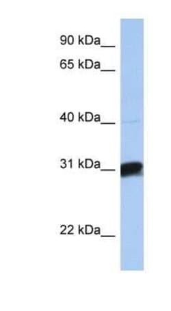 B3GALT6 Antibody, Novus Biologicals 100 &mu;g; Unconjugated:Antibodies,