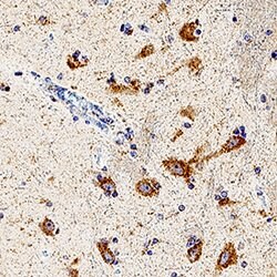 Human beta-1,3-Glucuronyltransferase 1/B3GAT1 Antibody, R D Systems:Antibodies:Primary