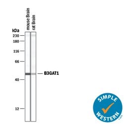 Human beta-1,3-Glucuronyltransferase 1/B3GAT1 Antibody, R D Systems:Antibodies:Primary
