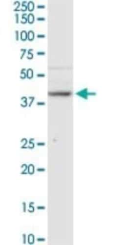 B3GNT3 Antibody, Novus Biologicals 0.1 mg | Buy Online | Novus Biologicals | Fisher Scientific