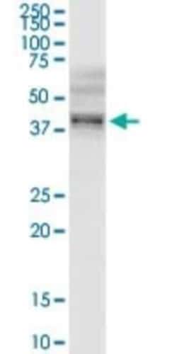 B3GNT3 Antibody, Novus Biologicals 0.1 mg | Buy Online | Novus Biologicals | Fisher Scientific