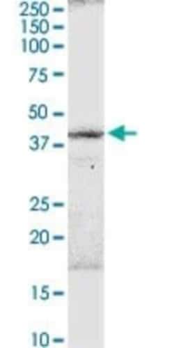 B3GNT3 Antibody, Novus Biologicals 0.1 mg | Buy Online | Novus Biologicals | Fisher Scientific