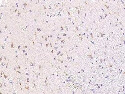 B4GALNT1 Antibody, Novus Biologicals 50 &mu;g, Unconjugated:Antibodies,