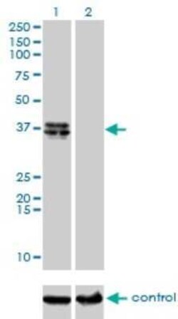 B4GALT4 Antibody (5E2), Novus Biologicals 0.1 mg | Buy Online | Novus Biologicals | Fisher Scientific
