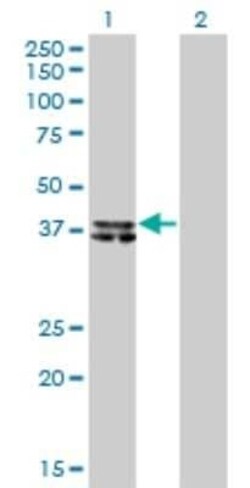 B4GALT4 Antibody (5E2), Novus Biologicals 0.1 mg | Buy Online | Novus Biologicals | Fisher Scientific