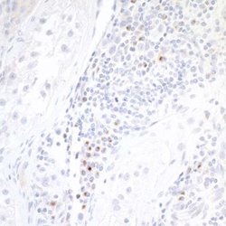 B7-2/CD86 Antibody (BLR030F), Novus Biologicals 100 &mu;L | Buy Online | Novus Biologicals | Fisher Scientific