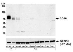B7-2/CD86 Antibody (BLR030F), Novus Biologicals 100 &mu;L | Buy Online | Novus Biologicals | Fisher Scientific