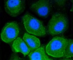 B7-2/CD86 Antibody (SJ20-00), Novus Biologicals 100&mu;L:Antibodies, Monoclonal