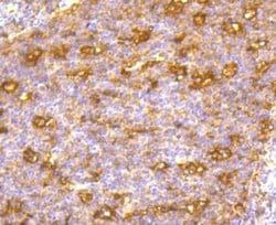 B7-2/CD86 Antibody (SJ20-00), Novus Biologicals 100&mu;L:Antibodies, Monoclonal