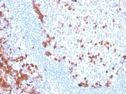 B7-H6 Mouse anti-Human, Clone: B7H6/4821, Novus Biologicals:Antibodies:Primary