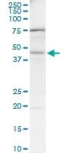 BAAT Antibody (1E4), Novus Biologicals 0.1 mg | Buy Online | Novus Biologicals | Fisher Scientific
