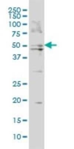 BAAT Antibody (5B6), Novus Biologicals 0.1 mg | Buy Online | Novus Biologicals | Fisher Scientific