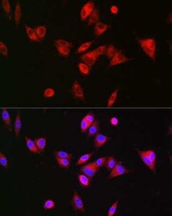 BAAT Antibody - BSA Free, Novus Biologicals 0.02 mL, Unconjugated:Antibodies,