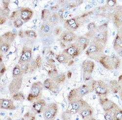 BAAT Antibody - BSA Free, Novus Biologicals 0.02 mL, Unconjugated:Antibodies,