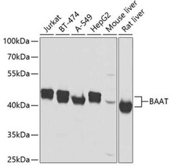 BAAT Antibody - BSA Free, Novus Biologicals 0.02 mL, Unconjugated:Antibodies,