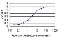 BACE-1 Antibody (2C1), Novus Biologicals 0.1 mg; Unconjugated:Anticuerpos
