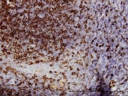 BACE-1 Antibody (2C1), Novus Biologicals 0.1 mg; Unconjugated:Anticuerpos