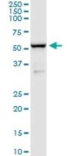 BACE-1 Antibody (2C1), Novus Biologicals 0.1 mg; Unconjugated:Anticuerpos
