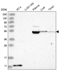 BACE-2 Antibody, Novus Biologicals 25ul; Unconjugated:Anticuerpos