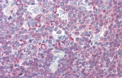 BACH2 Antibody, Novus Biologicals 100 &mu;L | Buy Online | Novus Biologicals | Fisher Scientific
