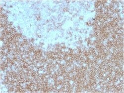 BAFFR/TNFRSF13C Mouse anti-Human, Clone: BAFFR/1557, Novus Biologicals:Antibodies:Primary