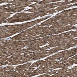 BAG2 Antibody, Novus Biologicals 0.1 mL, Unconjugated:Antibodies, Polyclonal