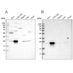 BAG2 Antibody, Novus Biologicals 0.1 mL, Unconjugated:Antibodies, Polyclonal