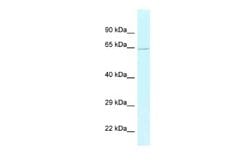 BAG5 Rabbit anti-Human, Polyclonal, Novus Biologicals 0.1 mL | Buy Online | Novus Biologicals | Fisher Scientific