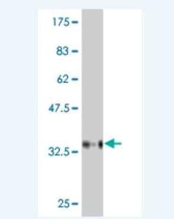 BAI2 Antibody (6A12), Novus Biologicals 0.1 mg | Buy Online | Novus Biologicals | Fisher Scientific